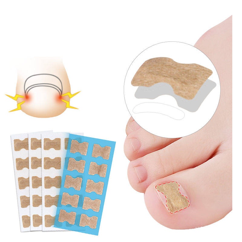 UÑIPATCH - PARCHES PARA HONGOS Y UÑAS ENCARNADAS 🩹